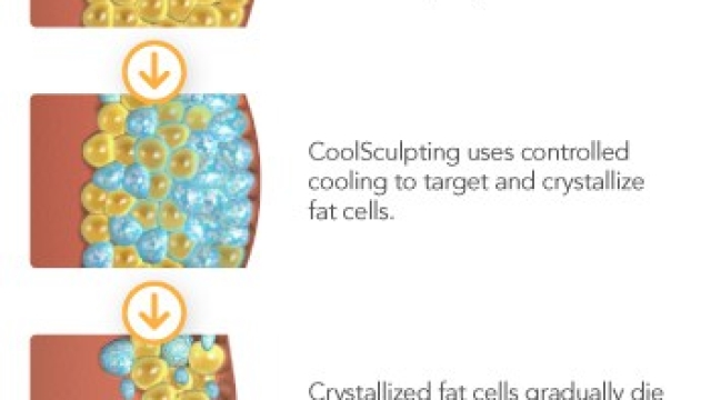 Frosting the Fat: Unveiling the Coolsculpting Revolution