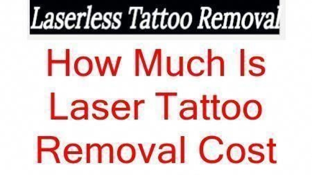 Laser Tattoo Removal – Frequently Asked Questions