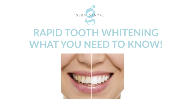 Unleash Your Pearly Whites: A Complete Guide to Teeth Whitening