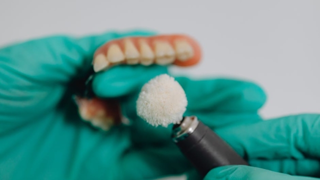 What to Expect During a Dental Consultation